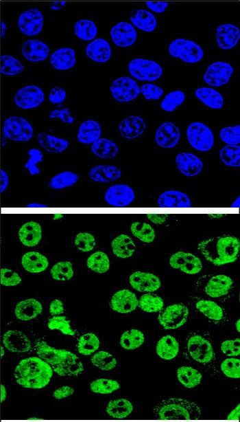 MDM2 Antibody in Immunocytochemistry (ICC/IF)