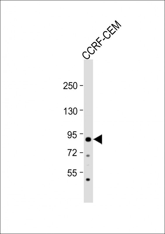 MDM2 Antibody in Western Blot (WB)