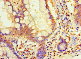 DIMT1 Antibody in Immunohistochemistry (Paraffin) (IHC (P))