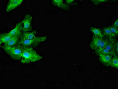 GAB2 Antibody in Immunocytochemistry (ICC/IF)