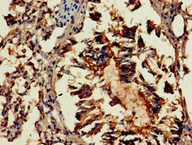 GAB2 Antibody in Immunohistochemistry (Paraffin) (IHC (P))