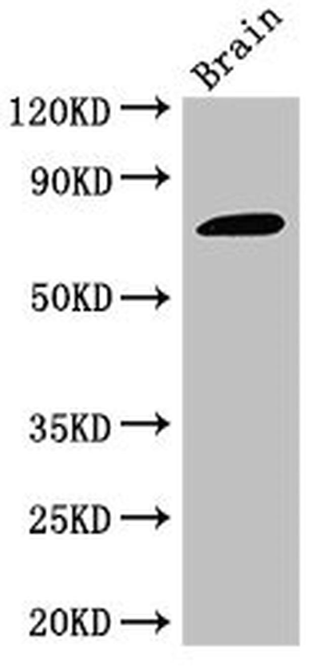 GAB2 Antibody in Western Blot (WB)