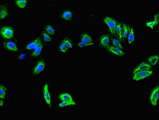 SLC7A7 Antibody in Immunocytochemistry (ICC/IF)