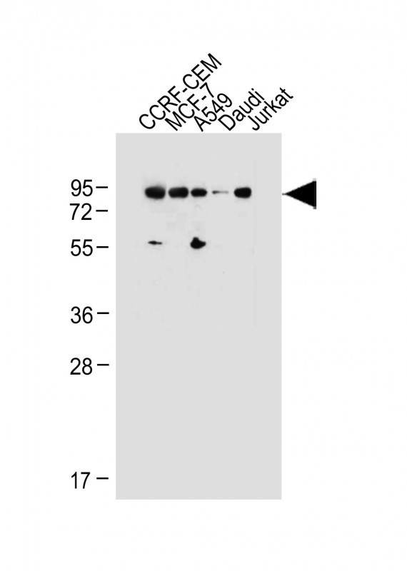 MDM2 Antibody in Western Blot (WB)