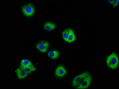 PACSIN3 Antibody in Immunocytochemistry (ICC/IF)