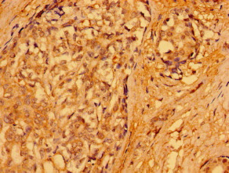 PACSIN3 Antibody in Immunohistochemistry (Paraffin) (IHC (P))