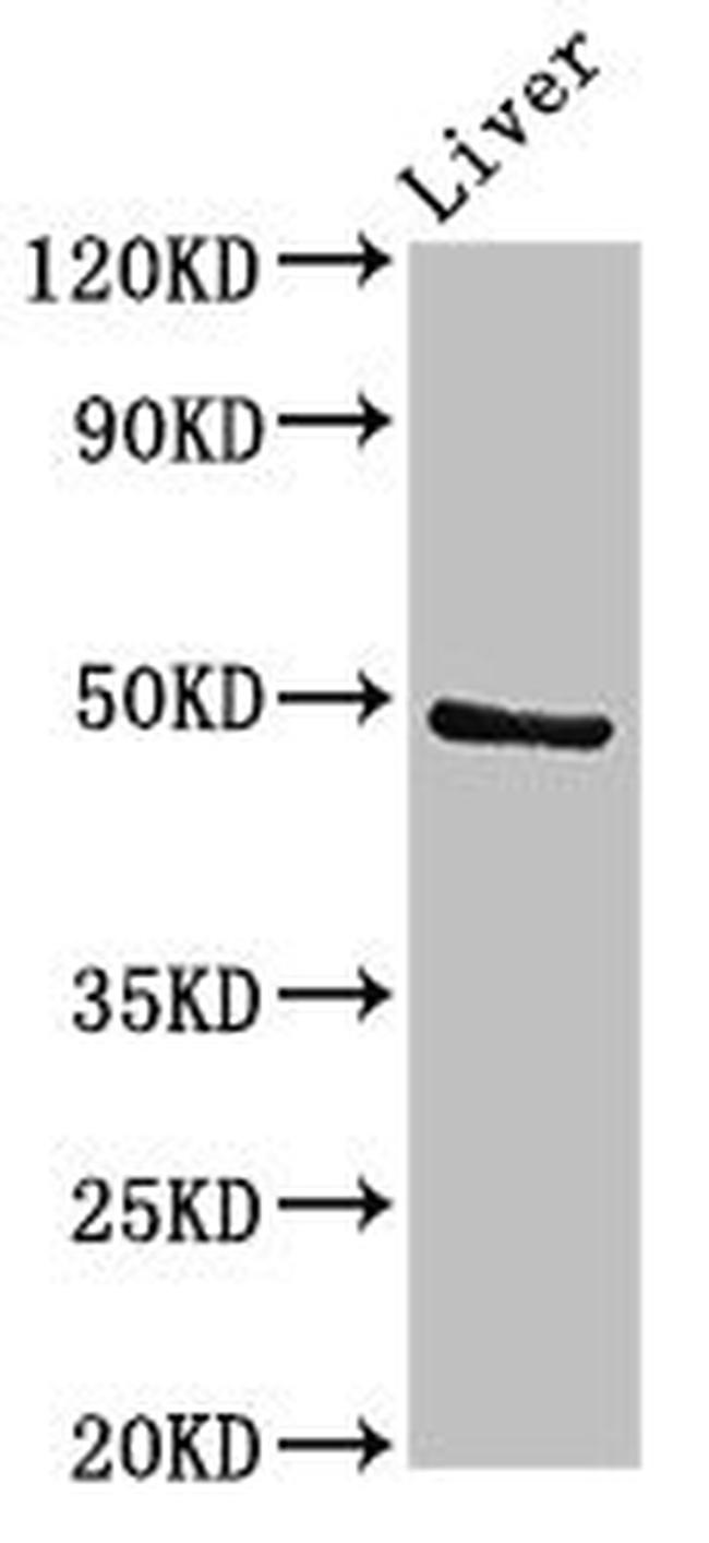 PACSIN3 Antibody in Western Blot (WB)