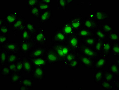 INO80 Antibody in Immunocytochemistry (ICC/IF)