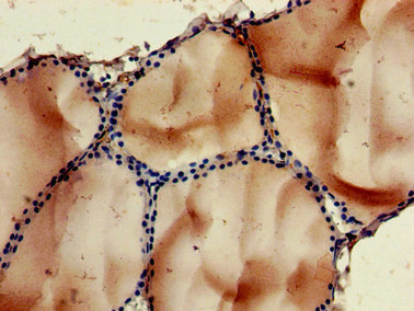 NOB1 Antibody in Immunohistochemistry (Paraffin) (IHC (P))