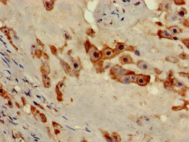 NOB1 Antibody in Immunohistochemistry (Paraffin) (IHC (P))