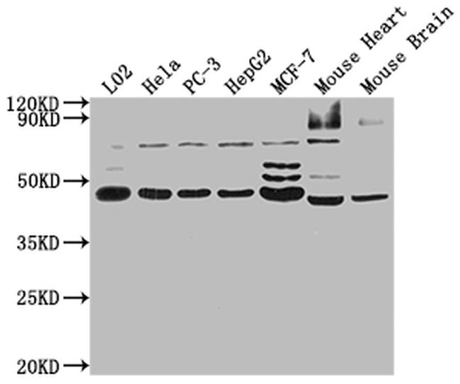 NOB1 Antibody in Western Blot (WB)