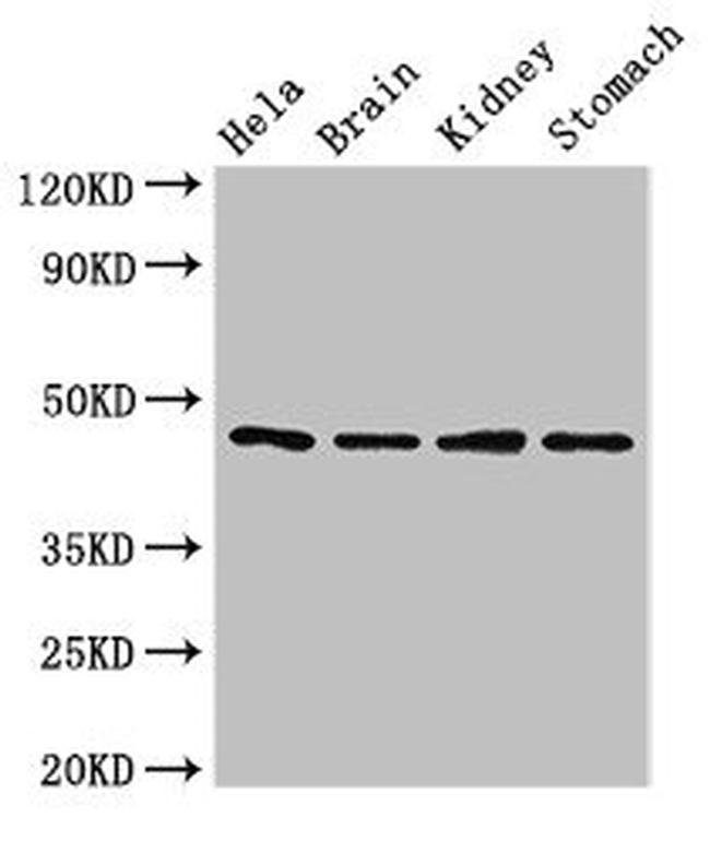 NOB1 Antibody in Western Blot (WB)