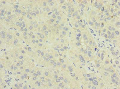 NME7 Antibody in Immunohistochemistry (Paraffin) (IHC (P))