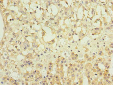 NME7 Antibody in Immunohistochemistry (Paraffin) (IHC (P))