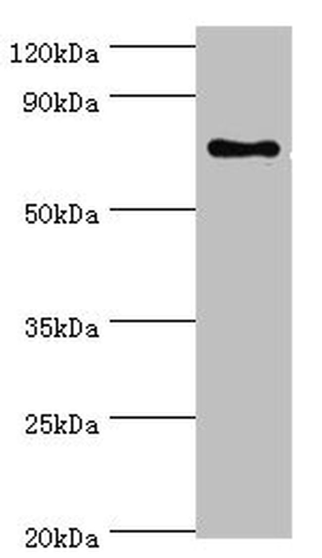 SLC27A6 Antibody in Western Blot (WB)