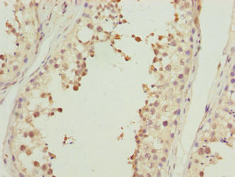 Actin-like 7B Antibody in Immunohistochemistry (Paraffin) (IHC (P))