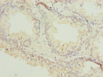 Actin-like 7B Antibody in Immunohistochemistry (Paraffin) (IHC (P))