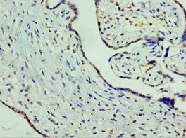 ORNT1 Antibody in Immunohistochemistry (Paraffin) (IHC (P))