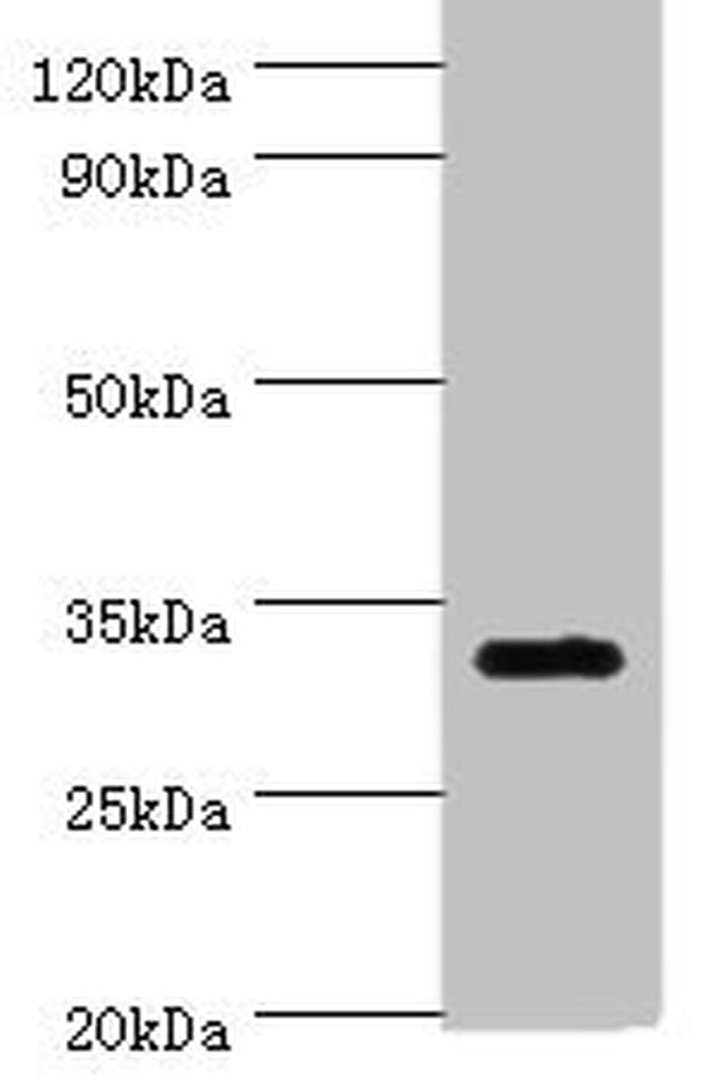 ORNT1 Antibody in Western Blot (WB)