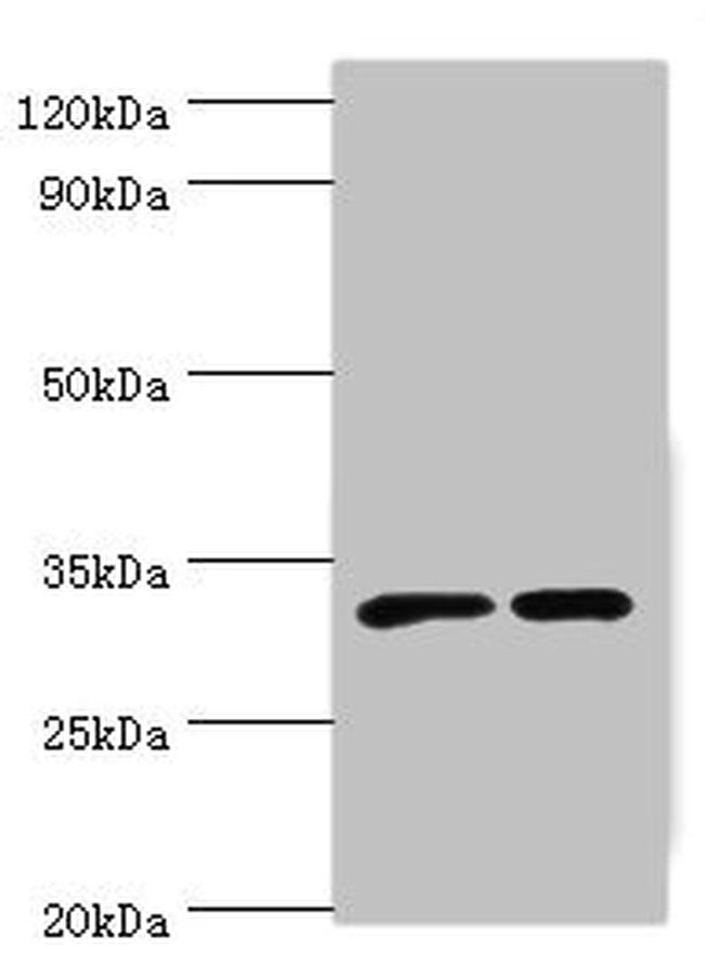 ORNT1 Antibody in Western Blot (WB)