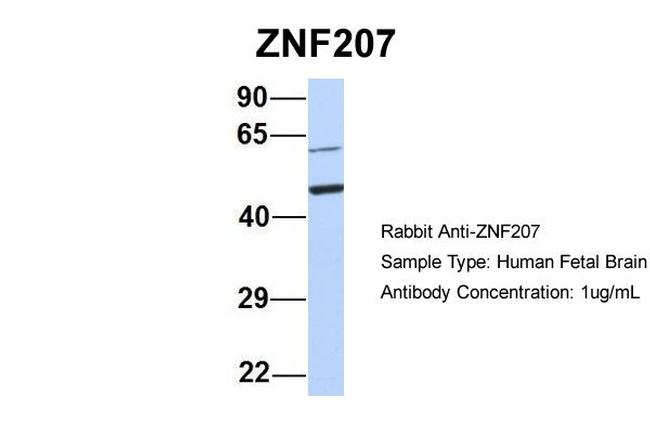 ZNF207 Antibody in Western Blot (WB)