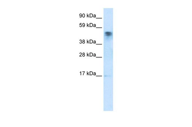 JMJD5 Antibody in Western Blot (WB)