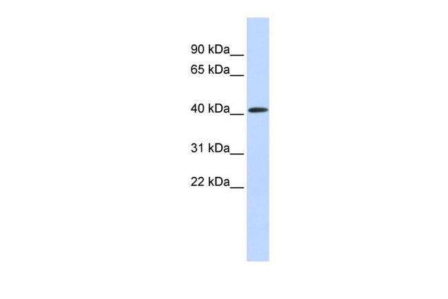 PARP11 Antibody in Western Blot (WB)