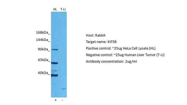 Kinesin 5B Antibody in Western Blot (WB)