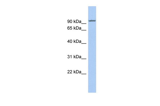 KIF9 Antibody in Western Blot (WB)