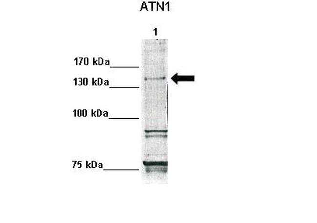 Atrophin 1 Antibody in Western Blot (WB)