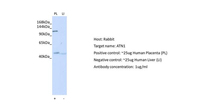 Atrophin 1 Antibody in Western Blot (WB)