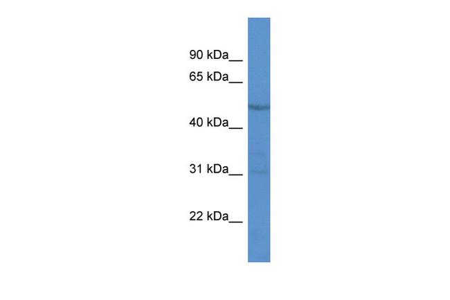 RAR gamma-1 Antibody in Western Blot (WB)