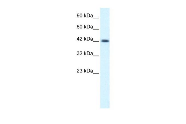 YBX1 Antibody in Western Blot (WB)