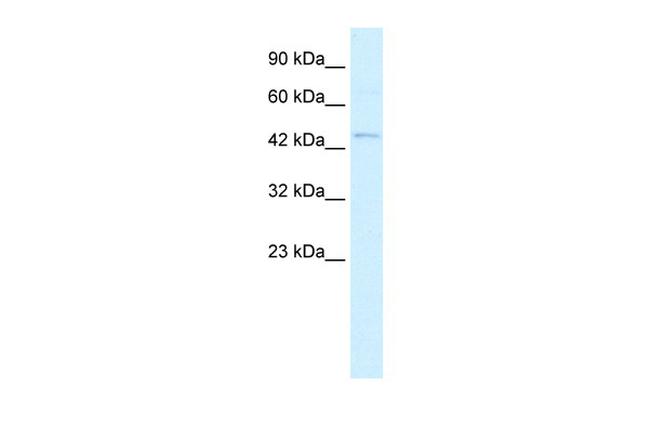 RNF36 Antibody in Western Blot (WB)