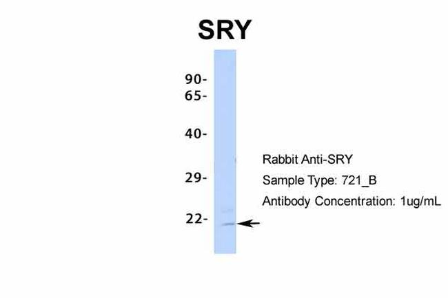 SRY Antibody in Western Blot (WB)