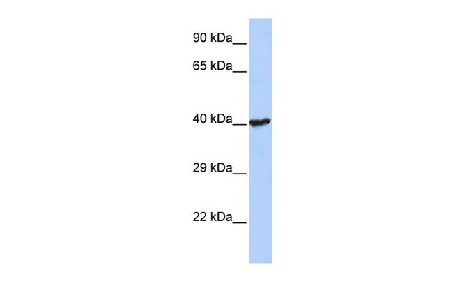 RNF113B Antibody in Western Blot (WB)