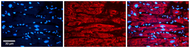 VDAC2 Antibody in Immunohistochemistry (Paraffin) (IHC (P))