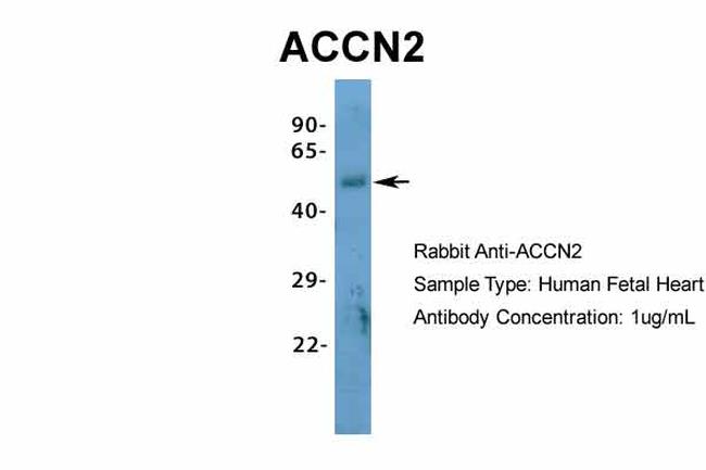 ASIC1 Antibody in Western Blot (WB)