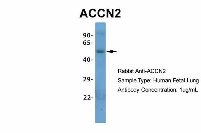 ASIC1 Antibody in Western Blot (WB)