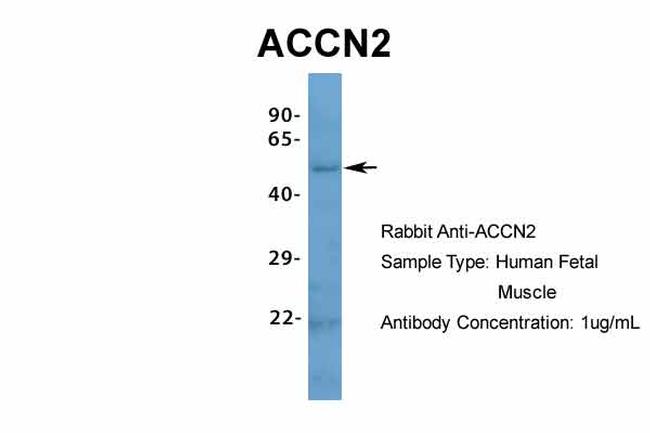 ASIC1 Antibody in Western Blot (WB)