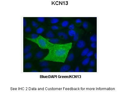 KCNK13 Antibody in Immunocytochemistry (ICC/IF)