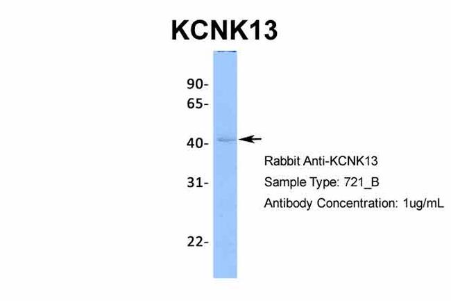 KCNK13 Antibody in Western Blot (WB)