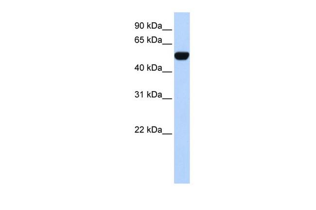 BTBD10 Antibody in Western Blot (WB)