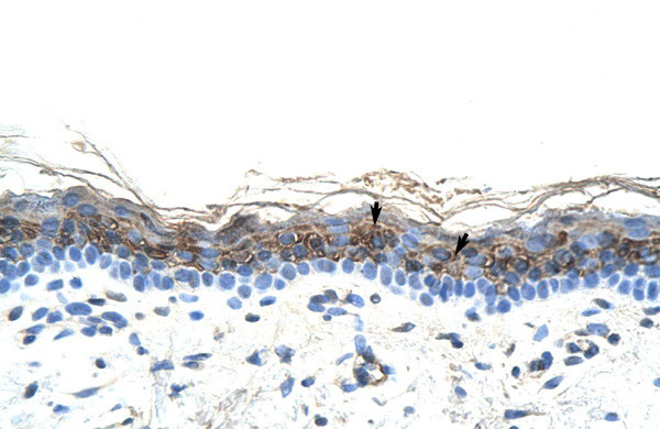 ZIC2 Antibody in Immunohistochemistry (IHC)