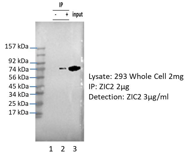ZIC2 Antibody in Immunoprecipitation (IP)