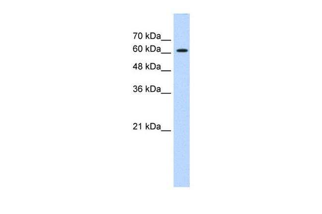 ZIC2 Antibody in Western Blot (WB)