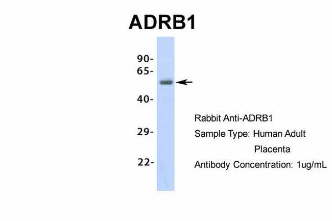 beta-1 Adrenergic Receptor Antibody in Western Blot (WB)