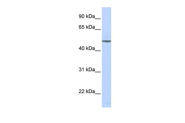 beta-1 Adrenergic Receptor Antibody in Western Blot (WB)