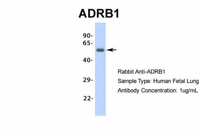 beta-1 Adrenergic Receptor Antibody in Western Blot (WB)