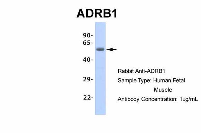 beta-1 Adrenergic Receptor Antibody in Western Blot (WB)